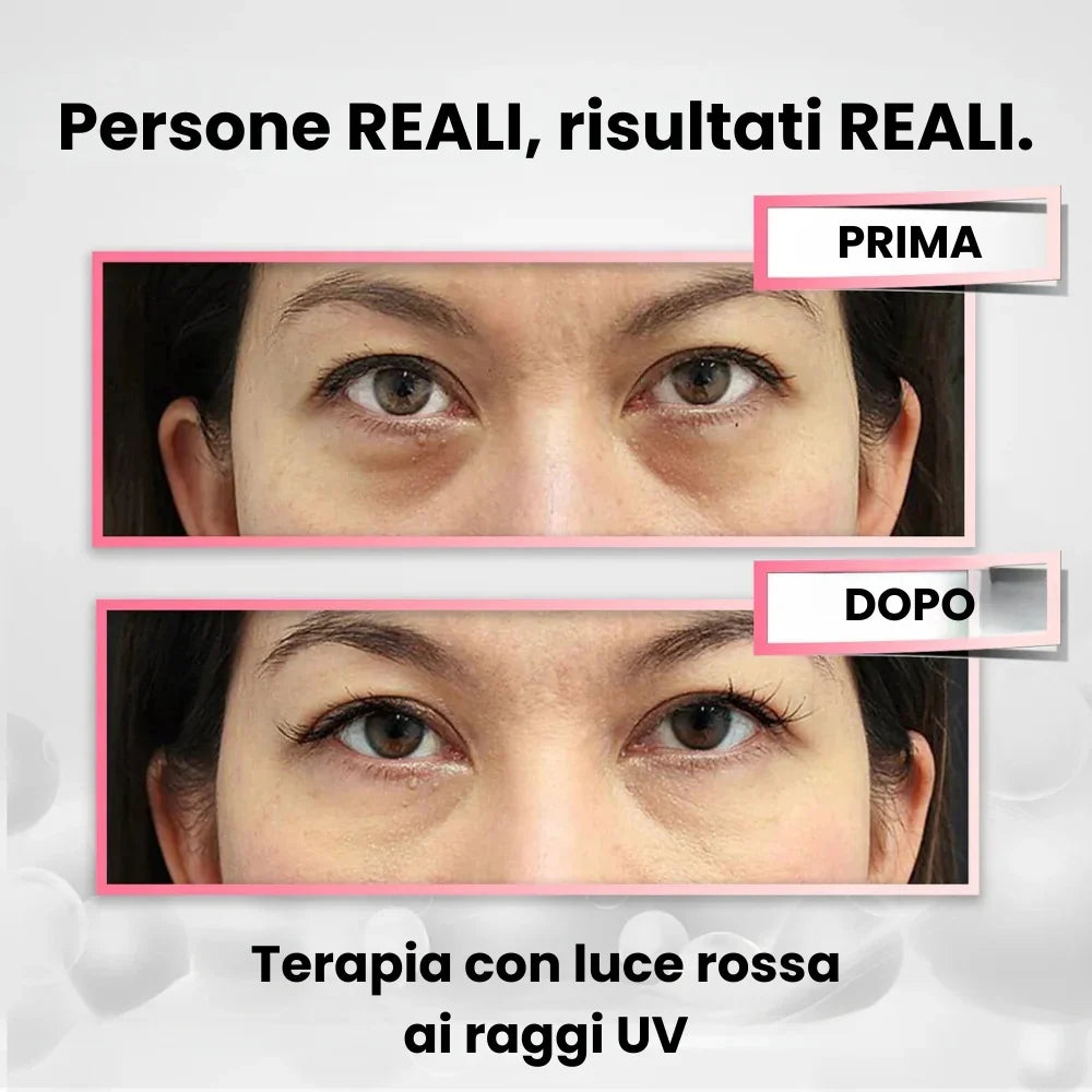 Massaggiatore Occhi Revitalizzante + Crema anti Rughe in OMAGGIO